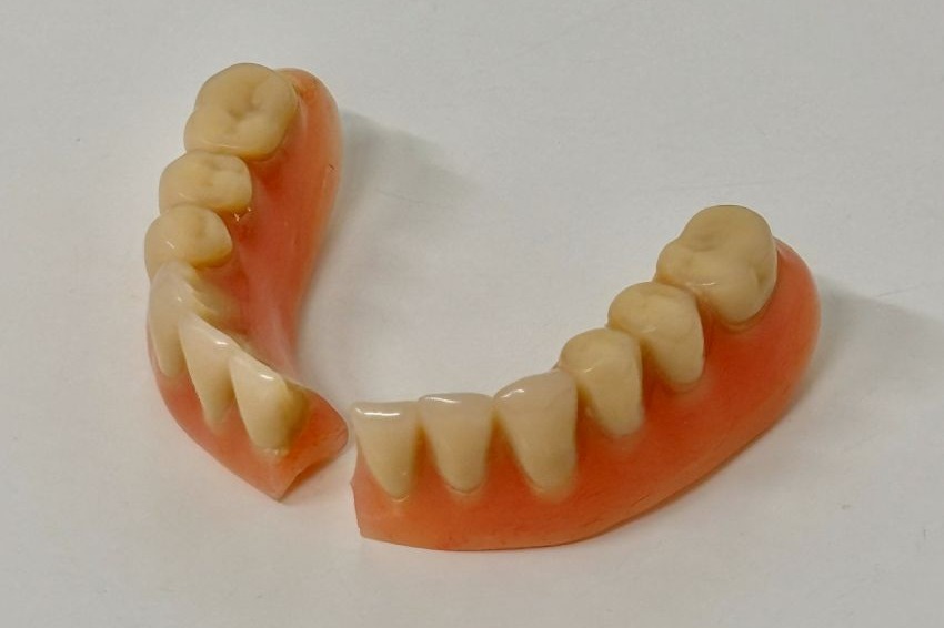 IMG_3222 Before (1) Broken denture for repair in Windsor