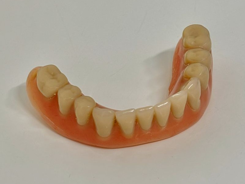 denture-repair-after-slide1 Repaired denture within 24 hours in Windsor